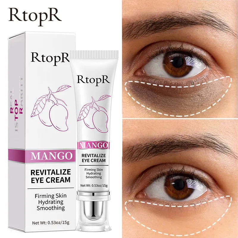 RtopR Mango Eye Cream