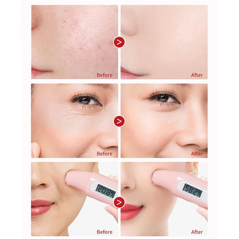 Vitamin A Alcohol Carnosine Retinol Skin Care Set