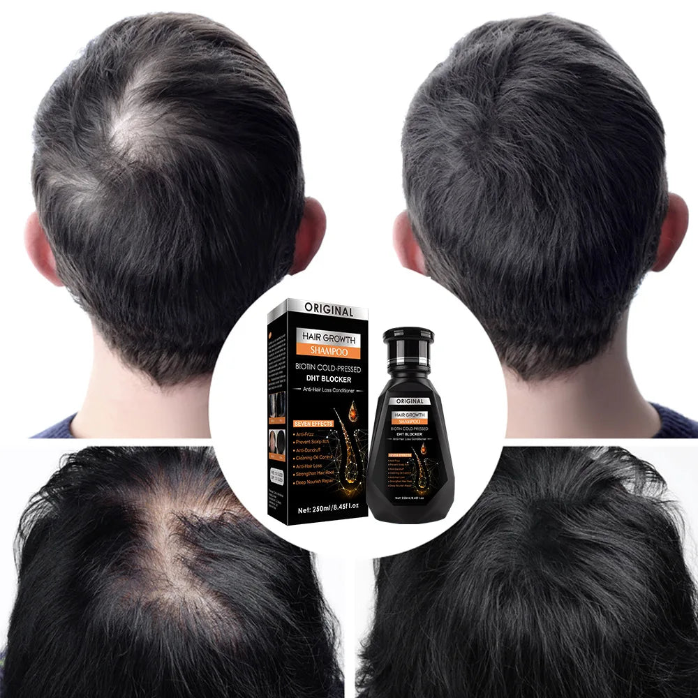 Ginger Hair growth moisturizing shampoo