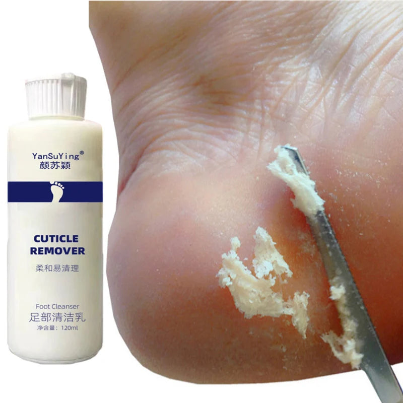 Foot Exfoliator