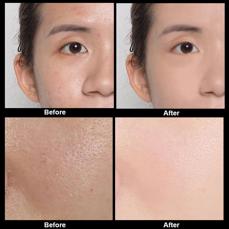 Caviar Antiwrinkle Moisturizing Hyaluronic Acid Facial Care Set