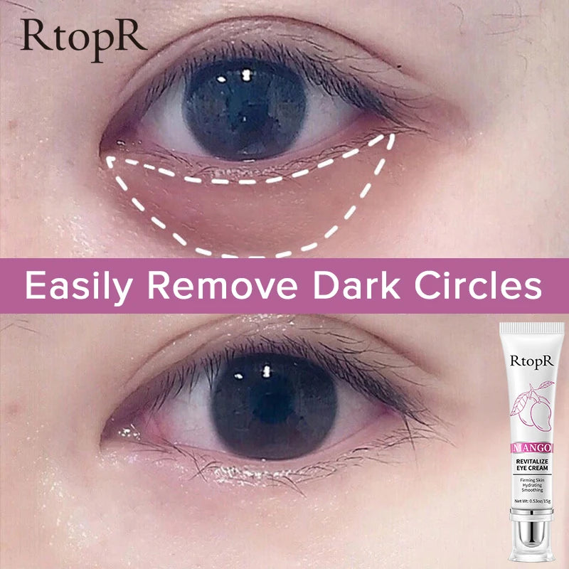 RtopR Mango Eye Cream