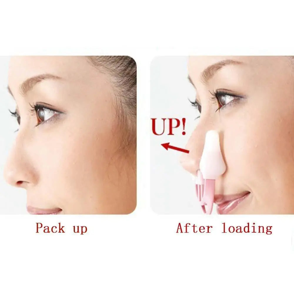 Nose Up Lifting Corrector