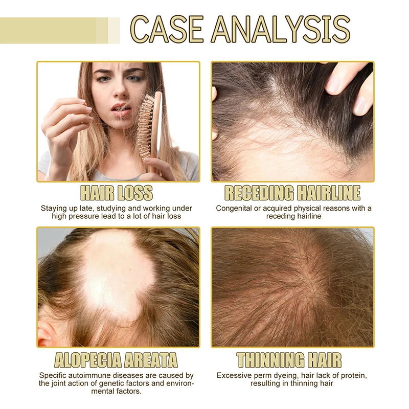 EELHOE Dense Hair Essential Oil