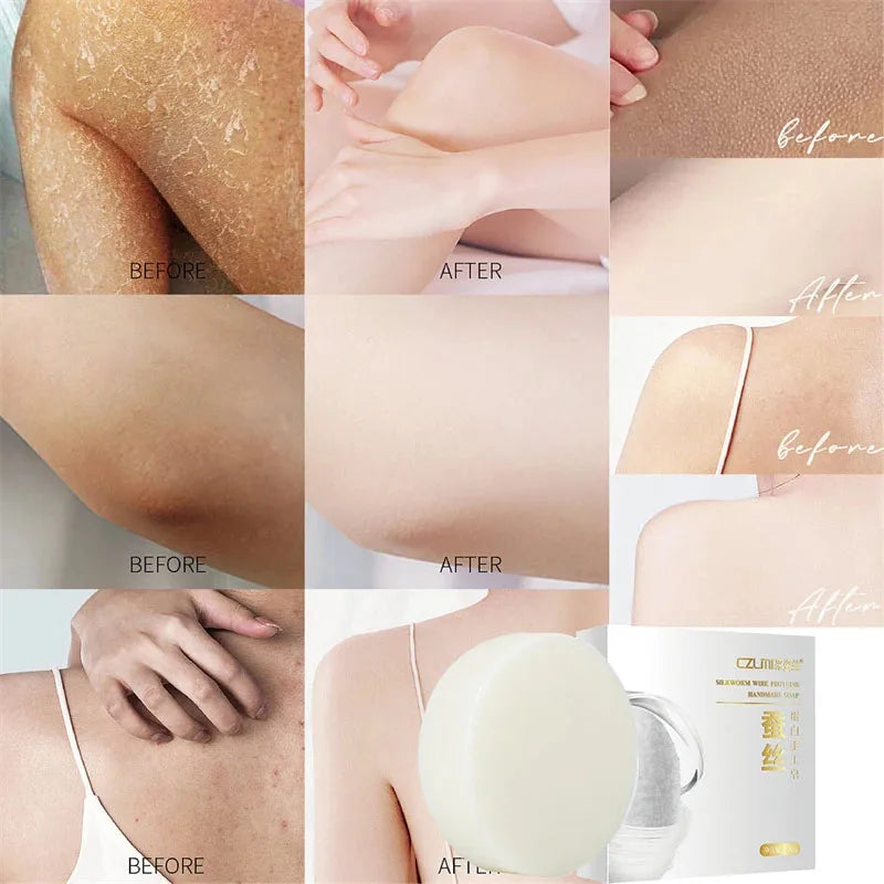 Whitening Soap Underarm Body Care