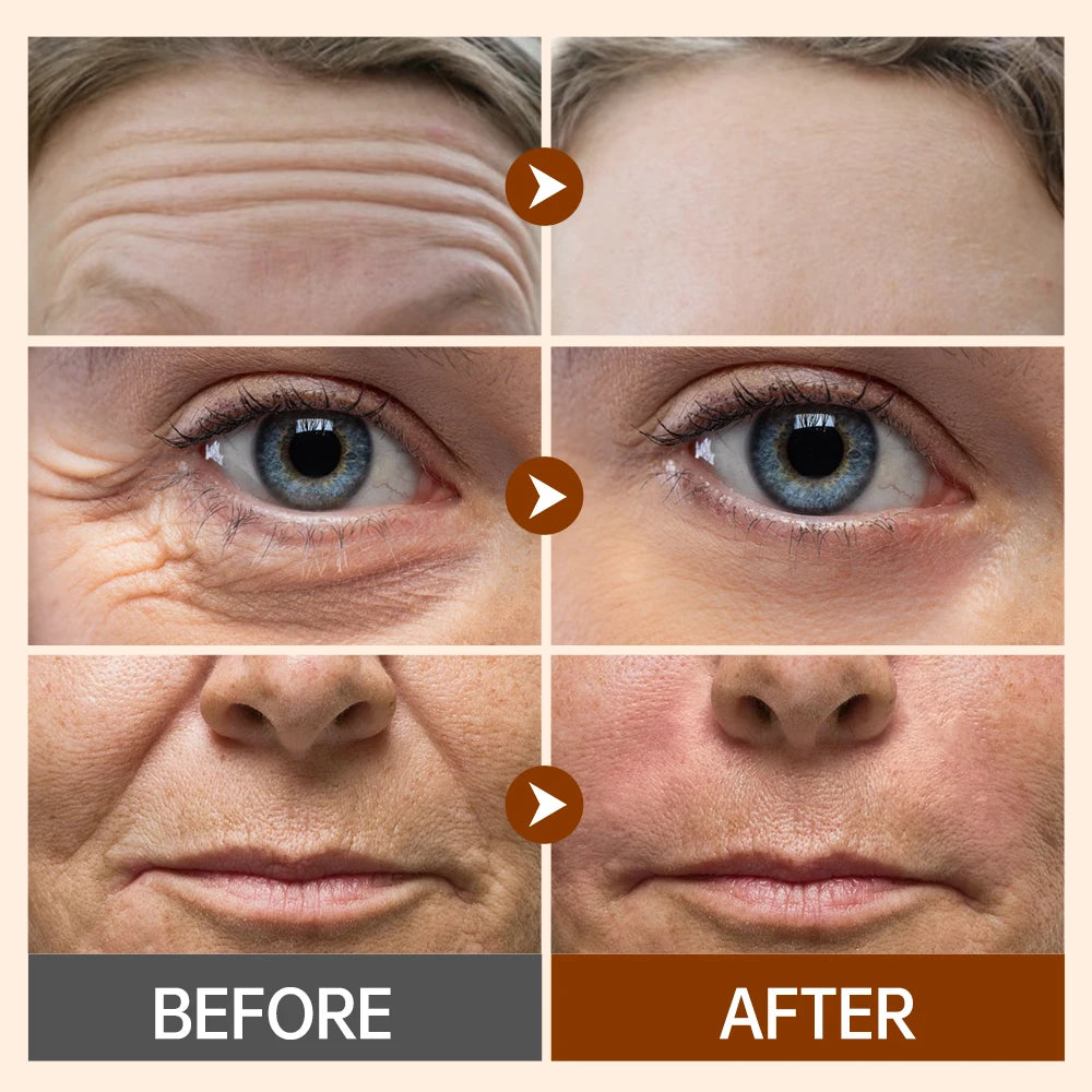 Wrinkle Retinol Face Cream