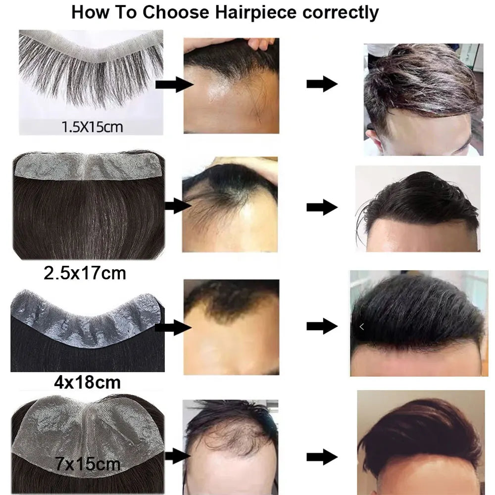 SEGO Hairline Toupee Hairpiece