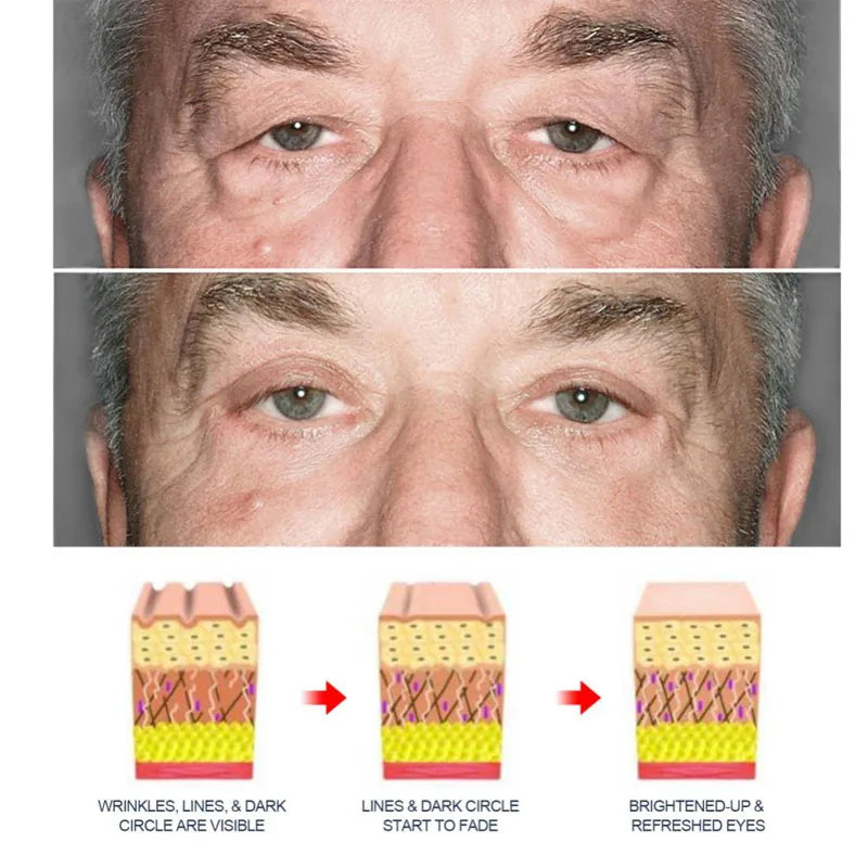 Men's Retinol Anti Wrinkle Eye Cream