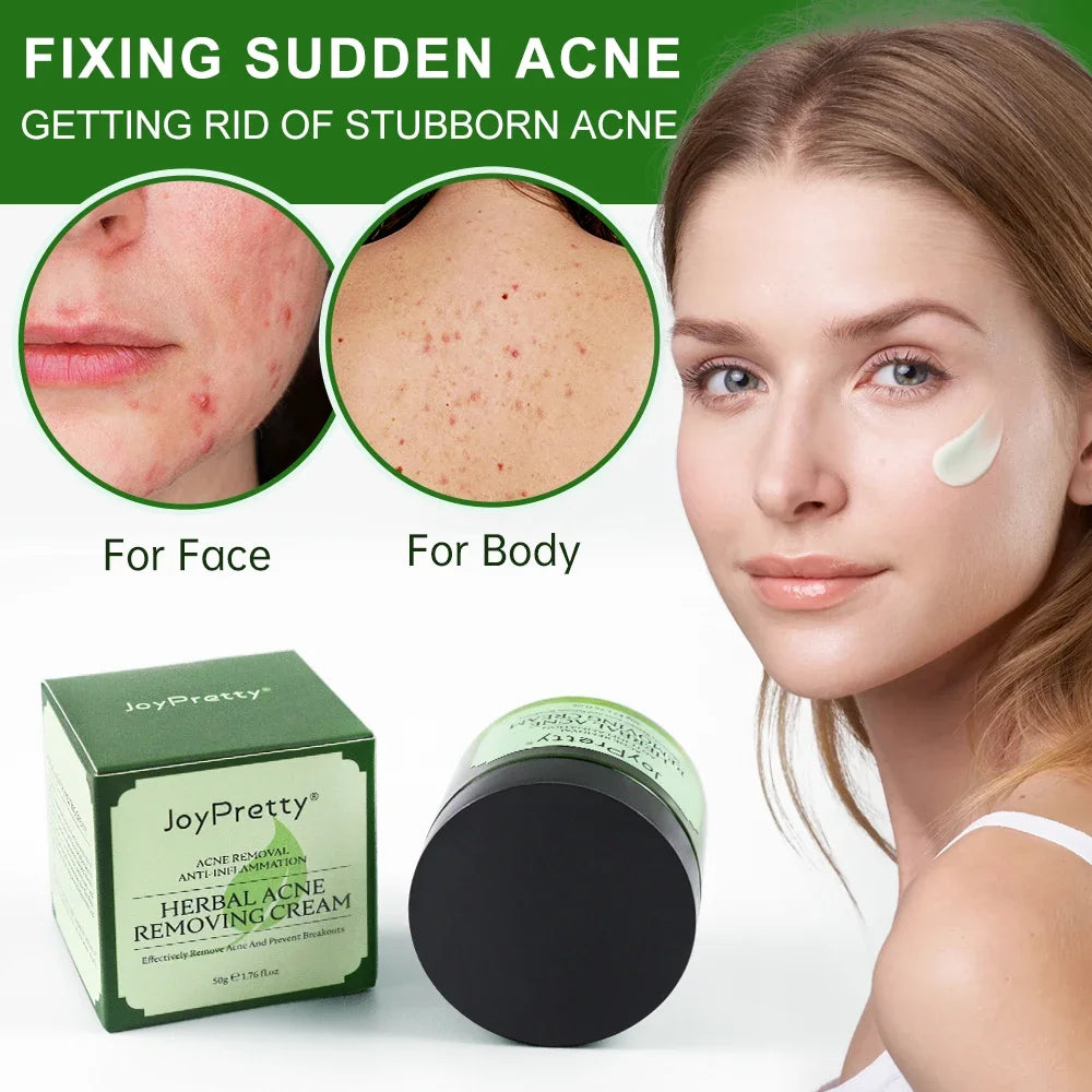 Acne Pore Skin Care Kit