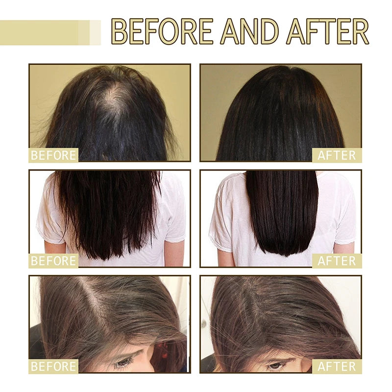 EELHOE Dense Hair Essential Oil