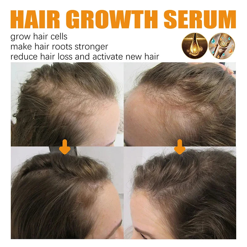 Ginger Hair Fast Growth Serum Spray