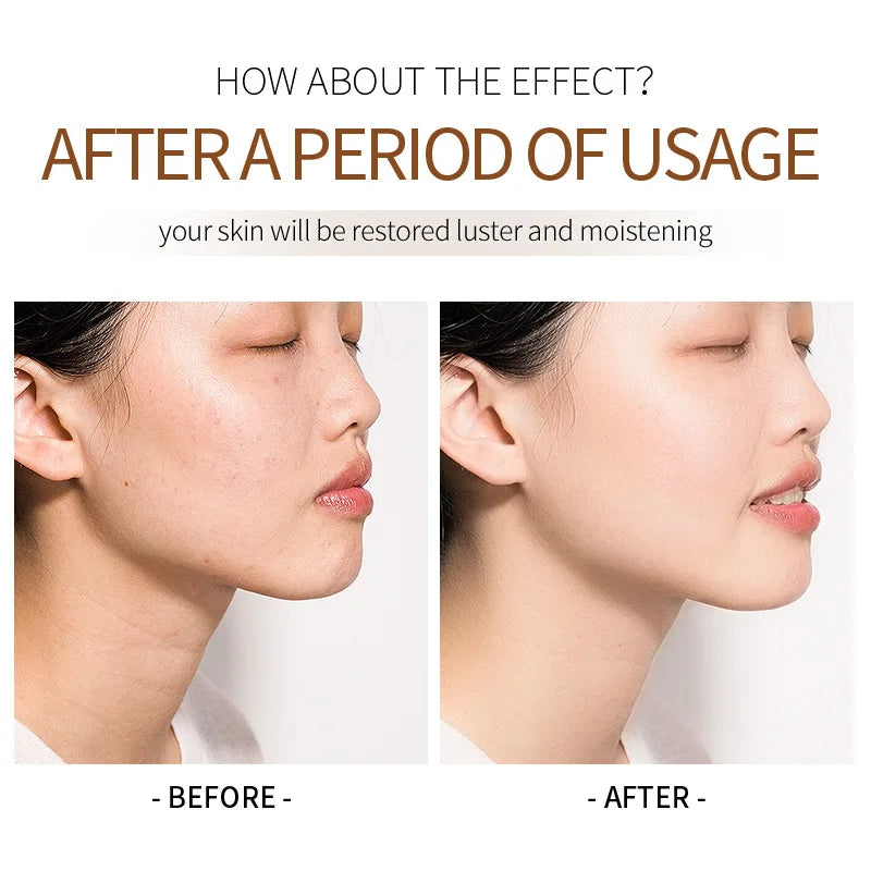 Wrinkle Removal Lanolin Oil Cream