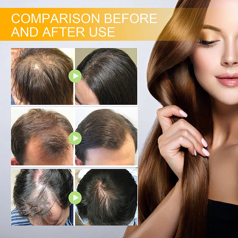 Ginger Hair Fast Growth Serum Spray