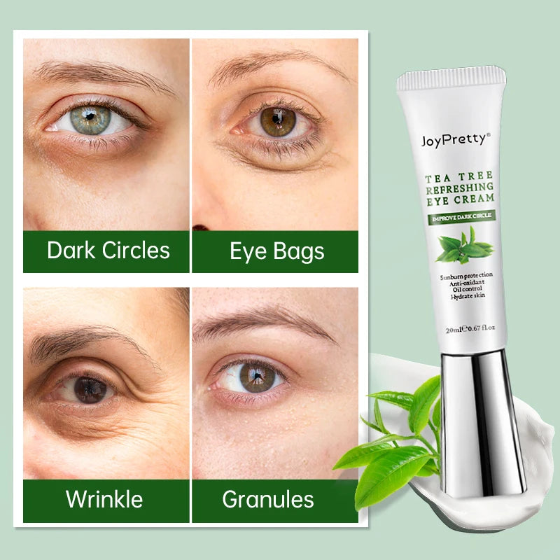 Acne Pore Skin Care Kit